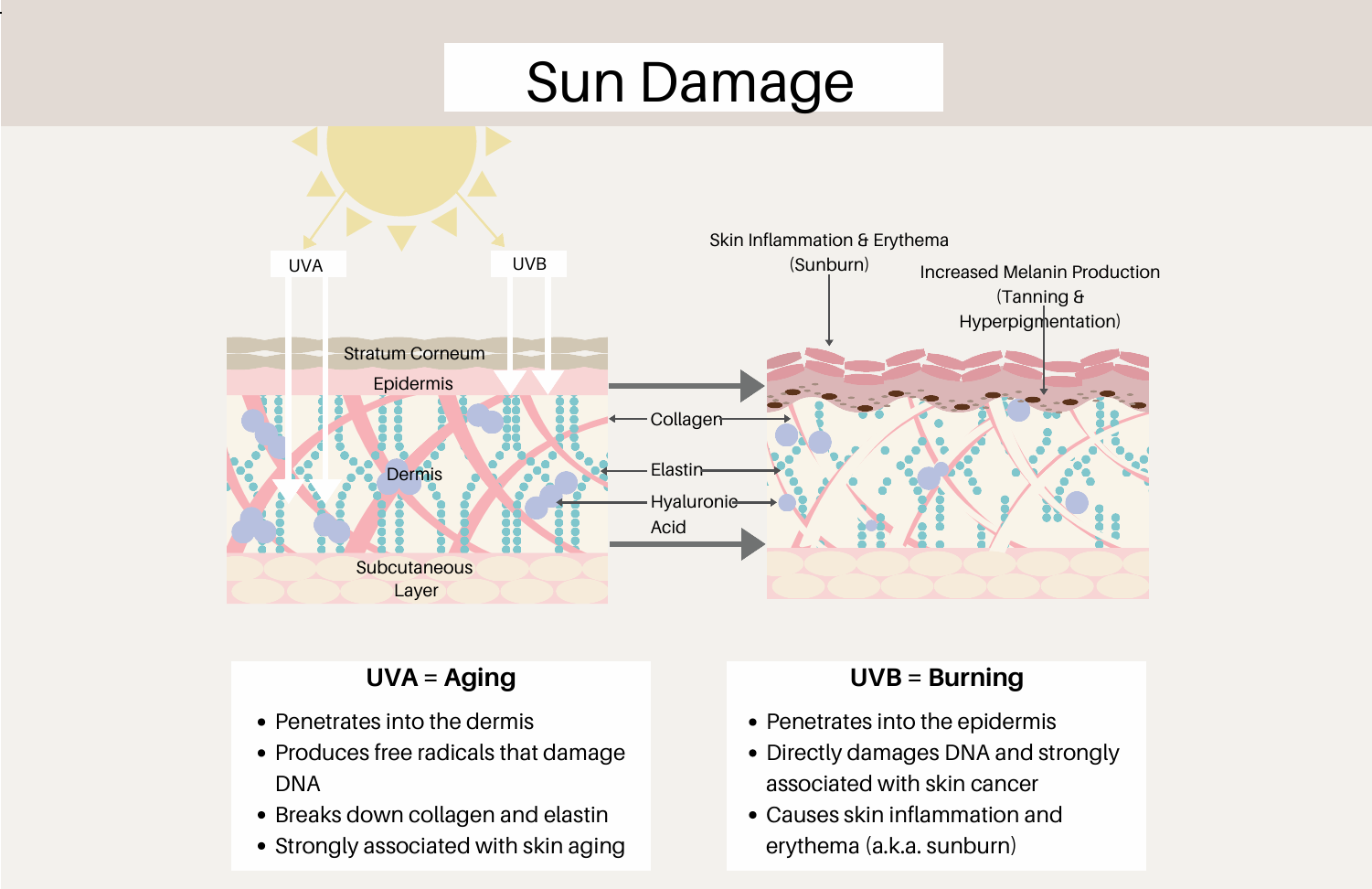 Sun damage