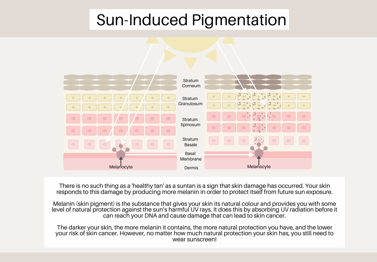Sun-induced