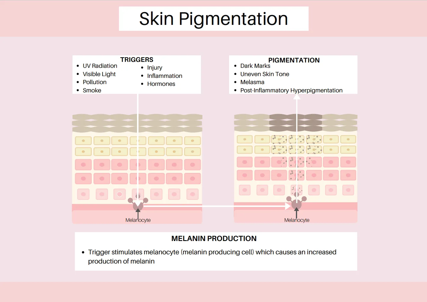 Pigmentation: What It Is, The Problems, and How to Fix